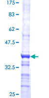 12.5% SDS-PAGE Stained with Coomassie Blue.